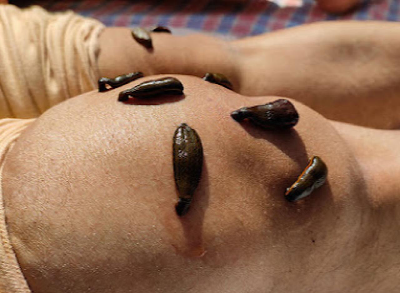 Vavuniya Ayurveda