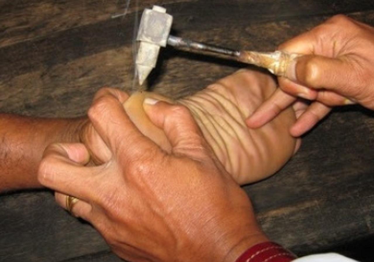 Vavuniya Ayurveda